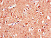 Immunohistochemistry of paraffin-embedded human brain tissue using CSB-PA12729A0Rb at dilution of 1:100