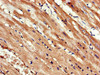 Immunohistochemistry of paraffin-embedded human heart tissue using CSB-PA613582LA01HU at dilution of 1:100