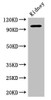 Western Blot<br />
 Positive WB detected in: Mouse kidney tissue<br />
 All lanes: AAK1 antibody at 2.5µg/ml<br />
 Secondary<br />
 Goat polyclonal to rabbit IgG at 1/50000 dilution<br />
 Predicted band size: 104, 94 kDa<br />
 Observed band size: 104 kDa<br />