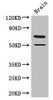 Western Blot<br />
 Positive WB detected in: Mouse brain tissue<br />
 All lanes: GRAMD4 antibody at 3.4µg/ml<br />
 Secondary<br />
 Goat polyclonal to rabbit IgG at 1/50000 dilution<br />
 Predicted band size: 67, 11 kDa<br />
 Observed band size: 67 kDa<br /> Western Blot<br />
 Positive WB detected in: Mouse brain tissue<br />
 All lanes: GRAMD4 antibody at 3.4µg/ml<br />
 Secondary<br />
 Goat polyclonal to rabbit IgG at 1/50000 dilution<br />
 Predicted band size: 67, 11 kDa<br />
 Observed band size: 67 kDa<br />