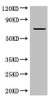 Western Blot<br />
 Positive WB detected in: MCF-7 whole cell lysate<br />
 All lanes: GRAMD4 antibody at 5µg/ml<br />
 Secondary<br />
 Goat polyclonal to rabbit IgG at 1/50000 dilution<br />
 Predicted band size: 67, 11 kDa<br />
 Observed band size: 67 kDa<br /> Western Blot<br />
 Positive WB detected in: MCF-7 whole cell lysate<br />
 All lanes: GRAMD4 antibody at 5µg/ml<br />
 Secondary<br />
 Goat polyclonal to rabbit IgG at 1/50000 dilution<br />
 Predicted band size: 67, 11 kDa<br />
 Observed band size: 67 kDa<br />