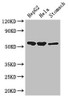 Western Blot<br />
 Positive WB detected in: HepG2 whole cell lysate, Hela whole cell lysate, Mouse stomach tissue<br />
 All lanes: SLC37A2 antibody at 3µg/ml<br />
 Secondary<br />
 Goat polyclonal to rabbit IgG at 1/50000 dilution<br />
 Predicted band size: 55, 43, 14 kDa<br />
 Observed band size: 55 kDa<br />