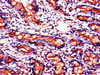 Immunohistochemistry of paraffin-embedded human small intestine tissue using CSB-PA819478LA01HU at dilution of 1:100