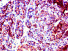 Immunohistochemistry of paraffin-embedded human pancreatic tissue using CSB-PA819478LA01HU at dilution of 1:100