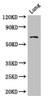 Western Blot<br />
 Positive WB detected in: Mouse lung tissue<br />
 All lanes: BBS1 antibody at 1µg/ml<br />
 Secondary<br />
 Goat polyclonal to rabbit IgG at 1/50000 dilution<br />
 Predicted band size: 66, 70, 50 kDa<br />
 Observed band size: 66 kDa<br />