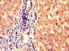 Immunohistochemistry of paraffin-embedded human liver tissue using CSB-PA836736LA01HU at dilution of 1:100