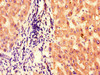 Immunohistochemistry of paraffin-embedded human liver tissue using CSB-PA836736LA01HU at dilution of 1:100 Immunohistochemistry of paraffin-embedded human liver tissue using CSB-PA836736LA01HU at dilution of 1:100