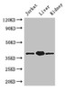 Western Blot<br />
 Positive WB detected in: Jurkat whole cell lysate, Mouse liver tissue, Mouse kidney tissue<br />
 All lanes: PINX1 antibody at 3.4µg/ml<br />
 Secondary<br />
 Goat polyclonal to rabbit IgG at 1/50000 dilution<br />
 Predicted band size: 38, 20 kDa<br />
 Observed band size: 38 kDa<br />