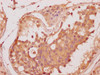 Immunohistochemistry of paraffin-embedded human testis tissue using CSB-PA850407LA01HU at dilution of 1:100