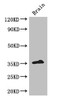 Western Blot<br />
 Positive WB detected in: Mouse brain tissue<br />
 All lanes: ZFP42 antibody at 3µg/ml<br />
 Secondary<br />
 Goat polyclonal to rabbit IgG at 1/50000 dilution<br />
 Predicted band size: 35 kDa<br />
 Observed band size: 35 kDa<br />