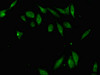 Immunofluorescent analysis of Hela cells using CSB-PA856985LA01HU at dilution of 1:100 and Alexa Fluor 488-congugated AffiniPure Goat Anti-Rabbit IgG (H+L)