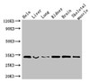 Western Blot<br />
 Positive WB detected in: Hela whole cell lysate, Mouse liver tissue, Mouse lung tissue, Mouse kidney tissue, Mouse brain tissue, Mouse skeletal muscle tissue<br />
 All lanes: CNN2 antibody at 2.5µg/ml<br />
 Secondary<br />
 Goat polyclonal to rabbit IgG at 1/50000 dilution<br />
 Predicted band size: 34, 30 kDa<br />
 Observed band size: 34 kDa<br />