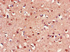 Immunohistochemistry of paraffin-embedded human brain tissue using CSB-PA880970LA01HU at dilution of 1:100