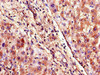 Immunohistochemistry of paraffin-embedded human liver tissue using CSB-PA882065LA01HU at dilution of 1:100