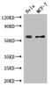 Western Blot<br />
 Positive WB detected in: Hela whole cell lysate, MCF-7 whole cell lysate<br />
 All lanes: PUF60 antibody at 2.7µg/ml<br />
 Secondary<br />
 Goat polyclonal to rabbit IgG at 1/50000 dilution<br />
 Predicted band size: 60, 59, 56, 55, 58 kDa<br />
 Observed band size: 60 kDa<br />