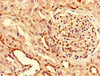 Immunohistochemistry of paraffin-embedded human kidney tissue using CSB-PA883409LA01HU at dilution of 1:100