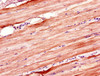 Immunohistochemistry of paraffin-embedded human skeletal muscle tissue using CSB-PA884622LA01HU at dilution of 1:100