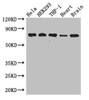 Western Blot<br />
 Positive WB detected in: Hela whole cell lysate, HEK293 whole cell lysate, THP-1 whole cell lysate, Mouse heart tissue, Mouse brain tissue<br />
 All lanes: FAF1 antibody at 2.8µg/ml<br />
 Secondary<br />
 Goat polyclonal to rabbit IgG at 1/50000 dilution<br />
 Predicted band size: 74, 57 kDa<br />
 Observed band size: 74 kDa<br />