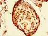 Immunohistochemistry of paraffin-embedded human testis tissue using CSB-PA892359LA01HU at dilution of 1:100