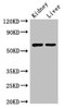 Western Blot<br />
 Positive WB detected in: Mouse kidney tissue, Mouse liver tissue<br />
 All lanes: ALDH6A1 antibody at 2.5µg/ml<br />
 Secondary<br />
 Goat polyclonal to rabbit IgG at 1/50000 dilution<br />
 Predicted band size: 58, 57 kDa<br />
 Observed band size: 58 kDa<br />