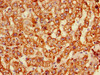 Immunohistochemistry of paraffin-embedded human liver tissue using CSB-PA001578LA01HU at dilution of 1:100