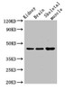 Western Blot<br />
 Positive WB detected in: Mouse kidney tissue, Mouse brain tissue, Mouse skeletal muscle tissue<br />
 All lanes: CASP4 antibody at 3.5µg/ml<br />
 Secondary<br />
 Goat polyclonal to rabbit IgG at 1/50000 dilution<br />
 Predicted band size: 44, 37, 14, 31, 19 kDa<br />
 Observed band size: 44 kDa<br />