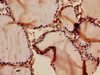 Immunohistochemistry of paraffin-embedded human thyroid tissue using CSB-PA004832LA01HU at dilution of 1:100