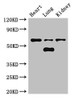 Western Blot<br />
 Positive WB detected in: Mouse heart tissue, Mouse lung tissue, Mouse kidney tissue<br />
 All lanes: CERK antibody at 3µg/ml<br />
 Secondary<br />
 Goat polyclonal to rabbit IgG at 1/50000 dilution<br />
 Predicted band size: 60, 38 kDa<br/>
 Observed band size: 60, 48 kDa<br/> Western Blot<br />
 Positive WB detected in: Mouse heart tissue, Mouse lung tissue, Mouse kidney tissue<br />
 All lanes: CERK antibody at 3µg/ml<br />
 Secondary<br />
 Goat polyclonal to rabbit IgG at 1/50000 dilution<br />
 Predicted band size: 60, 38 kDa<br/>
 Observed band size: 60, 48 kDa<br/>