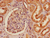 Immunohistochemistry of paraffin-embedded human kidney tissue using CSB-PA007724LA01HU at dilution of 1:100