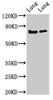 Western Blot<br />
 Positive WB detected in: Rat lung tissue, Mouse lung tissue<br />
 All lanes: FOXP1 antibody at 2µg/ml<br />
 Secondary<br />
 Goat polyclonal to rabbit IgG at 1/50000 dilution<br />
 Predicted band size: 76, 55, 66, 75, 13, 67, 78 kDa<br />
 Observed band size: 76 kDa<br />