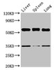 Western Blot<br />
 Positive WB detected in: Mouse liver tissue, Mouse spleen tissue, Mouse lung tissue<br />
 All lanes: Gba antibody at 3.5µg/ml<br />
 Secondary<br />
 Goat polyclonal to rabbit IgG at 1/50000 dilution<br />
 Predicted band size: 58 kDa<br />
 Observed band size: 58 kDa<br />