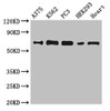 Western Blot<br />
 Positive WB detected in: A375 whole cell lysate, K562 whole cell lysate, PC-3 whole cell lysate, HEK293 whole cell lysate, Mouse heart tissue<br />
 All lanes: GBP2 antibody at 6.2µg/ml<br />
 Secondary<br />
 Goat polyclonal to rabbit IgG at 1/50000 dilution<br />
 Predicted band size: 68 kDa<br />
 Observed band size: 68 kDa<br />