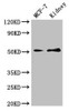 Western Blot<br />
 Positive WB detected in: MCF-7 whole cell lysate, Mouse kidney tissue<br />
 All lanes: GFRA1 antibody at 3µg/ml<br />
 Secondary<br />
 Goat polyclonal to rabbit IgG at 1/50000 dilution<br />
 Predicted band size: 52, 51 kDa<br />
 Observed band size: 52 kDa<br />