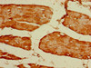 Immunohistochemistry of paraffin-embedded human skeletal muscle tissue using CSB-PA009914LA01HU at dilution of 1:100