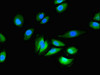 Immunofluorescent analysis of A549 cells using CSB-PA009914LA01HU at dilution of 1:100 and Alexa Fluor 488-congugated AffiniPure Goat Anti-Rabbit IgG (H+L)