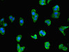 Immunofluorescent analysis of HepG2 cells using CSB-PA011818LA01HU at dilution of 1:100 and Alexa Fluor 488-congugated AffiniPure Goat Anti-Rabbit IgG (H+L)