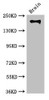 Western Blot<br />
 Positive WB detected in: Mouse brain tissue<br />
 All lanes: ITGB4 antibody at 3.5µg/ml<br />
 Secondary<br />
 Goat polyclonal to rabbit IgG at 1/50000 dilution<br />
 Predicted band size: 203, 196, 201, 195, 107 kDa<br />
 Observed band size: 203 kDa<br />