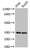 Western Blot<br />
 Positive WB detected in: A549 whole cell lysate, HepG2 whole cell lysate<br />
 All lanes: KLRK1 antibody at 3.7µg/ml<br />
 Secondary<br />
 Goat polyclonal to rabbit IgG at 1/50000 dilution<br />
 Predicted band size: 26 kDa<br />
 Observed band size: 34 kDa<br />