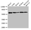 Western Blot<br />
 Positive WB detected in: Mouse heart tissue, Mouse lung tissue, Mouse brain tissue, Mouse kidney tissue, Mouse skeletal muscle tissue<br />
 All lanes: KPNA4 antibody at 3.5µg/ml<br />
 Secondary<br />
 Goat polyclonal to rabbit IgG at 1/50000 dilution<br />
 Predicted band size: 58 kDa<br />
 Observed band size: 58 kDa<br />