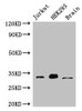 Western Blot<br />
 Positive WB detected in: Jurkat whole cell lysate, HEK293 whole cell lysate, Mouse brain tissue<br />
 All lanes: MBD3 antibody at 3µg/ml<br />
 Secondary<br />
 Goat polyclonal to rabbit IgG at 1/50000 dilution<br />
 Predicted band size: 33, 30 kDa<br />
 Observed band size: 33 kDa<br /> Western Blot<br />
 Positive WB detected in: Jurkat whole cell lysate, HEK293 whole cell lysate, Mouse brain tissue<br />
 All lanes: MBD3 antibody at 3µg/ml<br />
 Secondary<br />
 Goat polyclonal to rabbit IgG at 1/50000 dilution<br />
 Predicted band size: 33, 30 kDa<br />
 Observed band size: 33 kDa<br />