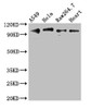 Western Blot<br />
 Positive WB detected in: A549 whole cell lysate, Hela whole cell lysate, RAW264.7 whole cell lysate, Mouse heart tissue<br />
 All lanes: TLR5 antibody at 3µg/ml<br />
 Secondary<br />
 Goat polyclonal to rabbit IgG at 1/50000 dilution<br />
 Predicted band size: 98 kDa<br />
 Observed band size: 98 kDa<br />