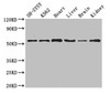 Western Blot<br />
 Positive WB detected in: SH-SY5Y whole cell lysate, K562 whole cell lysate, Mouse heart tissue, Mouse liver tissue, Mouse brain tissue, Mouse kidney tissue<br />
 All lanes: SLC16A9 antibody at 3.5µg/ml<br />
 Secondary<br />
 Goat polyclonal to rabbit IgG at 1/50000 dilution<br />
 Predicted band size: 56 kDa<br />
 Observed band size: 56 kDa<br />