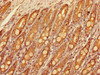 Immunohistochemistry of paraffin-embedded human small intestine tissue using CSB-PA742402LA01HU at dilution of 1:100