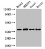 Western Blot<br />
 Positive WB detected in: HepG2 whole cell lysate, HEK293 whole cell lysate, Mouse heart tissue, Mouse brain tissue<br />
 All lanes: PNKD antibody at 2.8µg/ml<br />
 Secondary<br />
 Goat polyclonal to rabbit IgG at 1/50000 dilution<br />
 Predicted band size: 43, 16, 41, 37 kDa<br />
 Observed band size: 37 kDa<br />