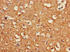 Immunohistochemistry of paraffin-embedded human brain tissue using CSB-PA844728LA01HU at dilution of 1:100 Immunohistochemistry of paraffin-embedded human brain tissue using CSB-PA844728LA01HU at dilution of 1:100