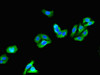 Immunofluorescent analysis of HepG2 cells using CSB-PA844728LA01HU at dilution of 1:100 and Alexa Fluor 488-congugated AffiniPure Goat Anti-Rabbit IgG (H+L) Immunofluorescent analysis of HepG2 cells using CSB-PA844728LA01HU at dilution of 1:100 and Alexa Fluor 488-congugated AffiniPure Goat Anti-Rabbit IgG (H+L)