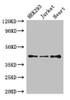 Western Blot<br />
 Positive WB detected in: HEK293 whole cell lysate, Jurkat whole cell lysate, Mouse heart tissue<br />
 All lanes: S1PR5 antibody at 4µg/ml<br />
 Secondary<br />
 Goat polyclonal to rabbit IgG at 1/50000 dilution<br />
 Predicted band size: 42, 33 kDa<br />
 Observed band size: 42 kDa<br /> Western Blot<br />
 Positive WB detected in: HEK293 whole cell lysate, Jurkat whole cell lysate, Mouse heart tissue<br />
 All lanes: S1PR5 antibody at 4µg/ml<br />
 Secondary<br />
 Goat polyclonal to rabbit IgG at 1/50000 dilution<br />
 Predicted band size: 42, 33 kDa<br />
 Observed band size: 42 kDa<br />
