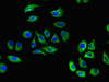 Immunofluorescent analysis of A549 cells using CSB-PA867132LA01HU at dilution of 1:100 and Alexa Fluor 488-congugated AffiniPure Goat Anti-Rabbit IgG (H+L) Immunofluorescent analysis of A549 cells using CSB-PA867132LA01HU at dilution of 1:100 and Alexa Fluor 488-congugated AffiniPure Goat Anti-Rabbit IgG (H+L)