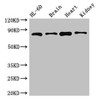 Western Blot<br />
 Positive WB detected in: HL60 whole cell lysate, Mouse brain tissue, Mouse heart tissue, Mouse kidney tissue<br />
 All lanes: ABCB9 antibody at 5µg/ml<br />
 Secondary<br />
 Goat polyclonal to rabbit IgG at 1/50000 dilution<br />
 Predicted band size: 85, 80, 67, 76, 78 kDa<br />
 Observed band size: 85 kDa<br />