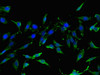 Immunofluorescent analysis of Hela cells using CSB-PA889078LA01HU at dilution of 1:100 and Alexa Fluor 488-congugated AffiniPure Goat Anti-Rabbit IgG (H+L)